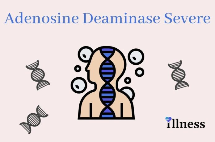 Adenosine Deaminase Severe Combined Immunodeficiency (ada-scid)
