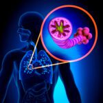 Chronic Obstructive Pulmonary Disease – Copd