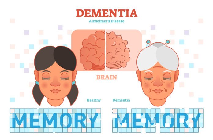 Dementia And Alzheimer’s
