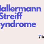 Hallermann-streiff Syndrome