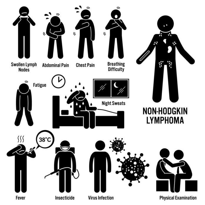 Non-hodgkin’s Lymphoma