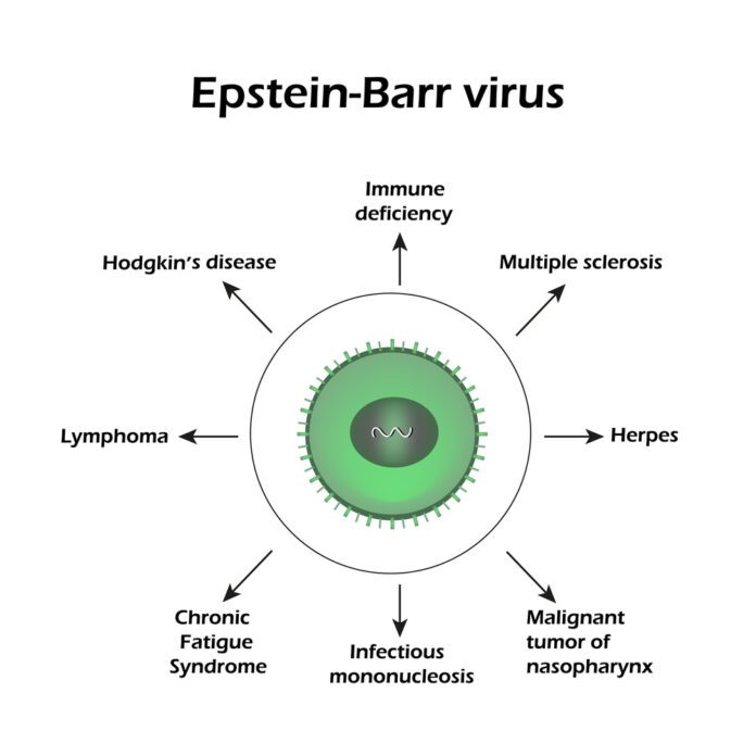 EBV Antibody Test