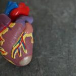 Congenital Heart Defect - PFO