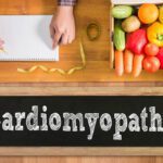 Idiopathic Cardiomyopathy