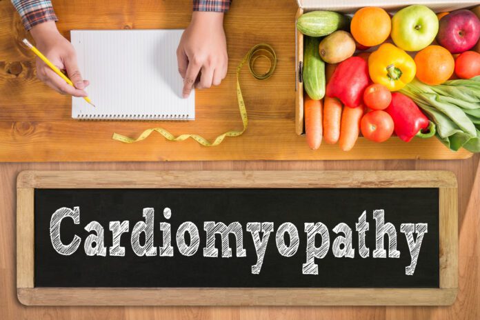 Idiopathic Cardiomyopathy