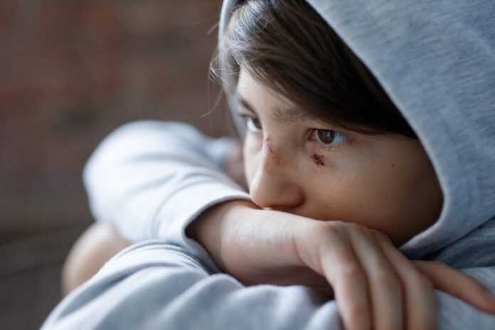 Manic Depression In Children And Teens