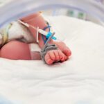 Neonatal Listeriosis