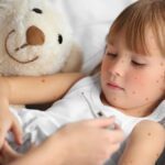 Rash And Other Skin Problems In Children