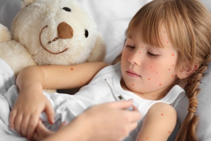 Rash And Other Skin Problems In Children