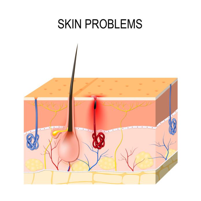 Skin Problems In Adults