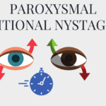 Paroxysmal Positional Nystagmus