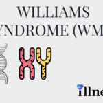 Williams-Beuren Syndrome (WBS)