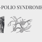 Post-Polio Syndrome (PPS)