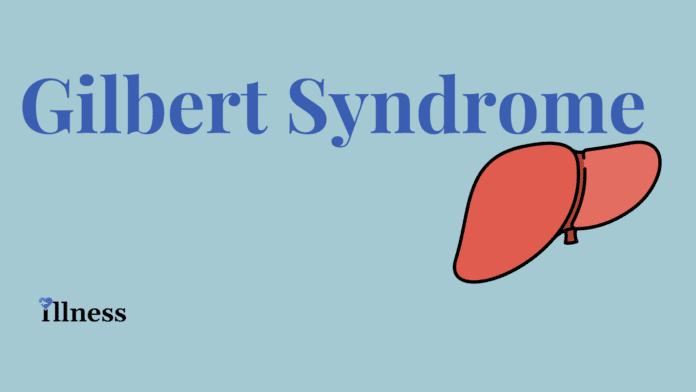 Gilbert Syndrome