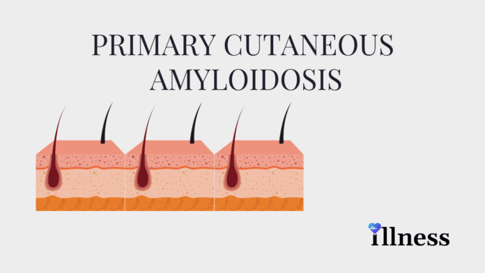 Primary Cutaneous Amyloidosis