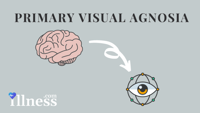 Primary Visual Agnosia