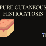 Pure Cutaneous Histiocytosis