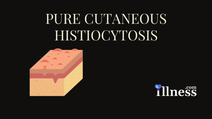 Pure Cutaneous Histiocytosis