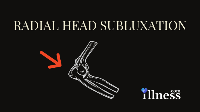 Radial Head Subluxation