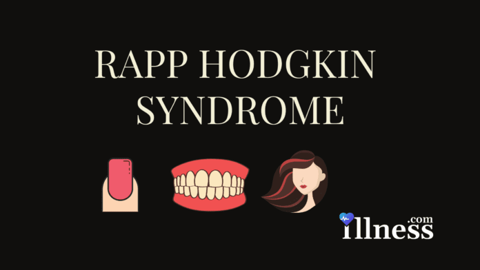 Rapp Hodgkin Syndrome