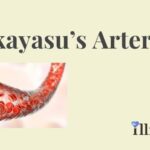 Takayasu’s Arteritis