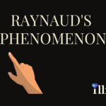 Raynaud's Disease