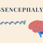 Lissencephaly With Cerebellar Hypoplasia