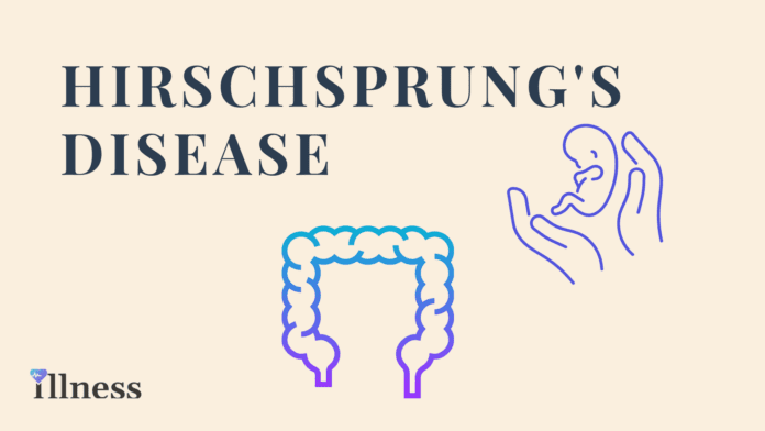 Hirschsprung's Disease