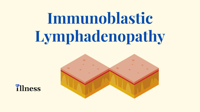 Immunoblastic Lymphadenopathy