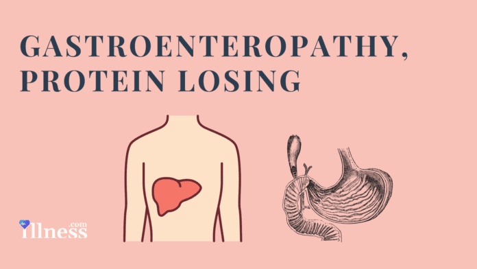 Gastroenteropathy, Protein Losing