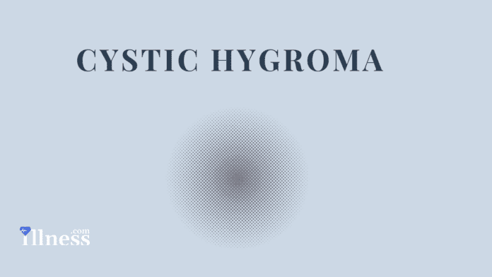 Cystic Hygroma
