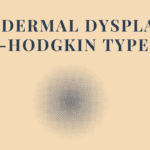 Ectodermal Dysplasia, Rapp-Hodgkin Type