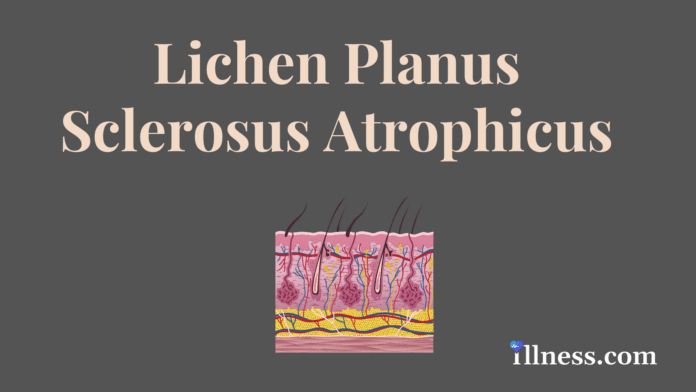 Lichen Planus Sclerosus Atrophicus