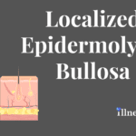 Localized Epidermolysis Bullosa