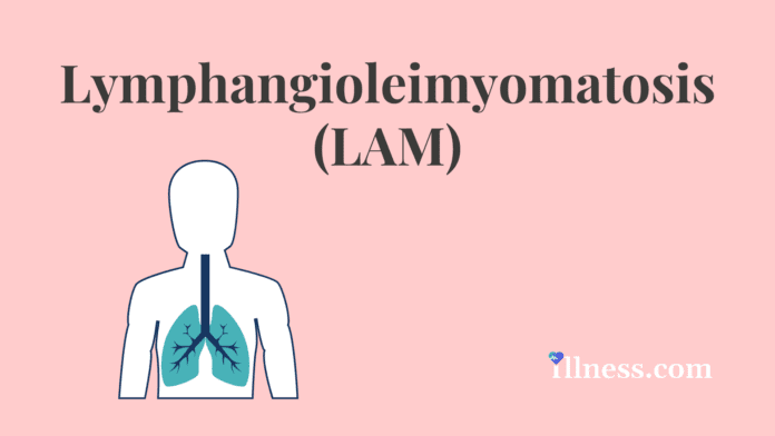 Lymphangioleimyomatosis