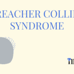 Treacher Collins Syndrome