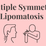 Multiple Symmetric Lipomatosis
