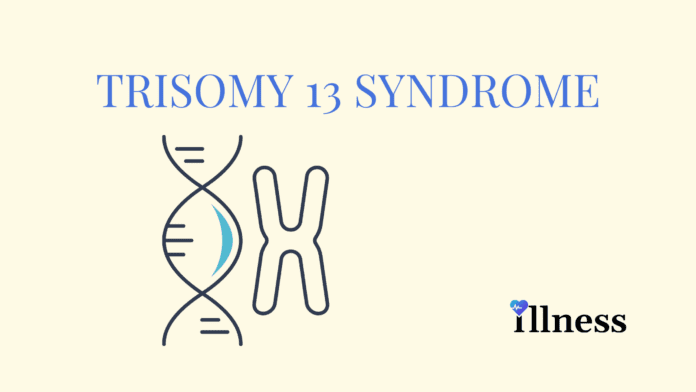 Trisomy 13 Syndrome