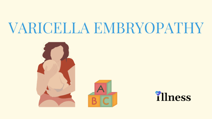 Varicella Embryopathy
