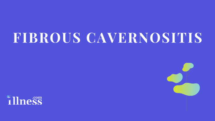 Fibrous Cavernositis