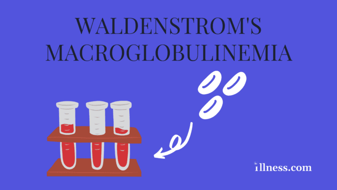 Waldenström Macroglobulinemia