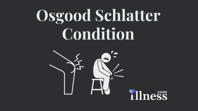 Osgood Schlatter Condition