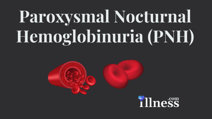 Paroxysmal Nocturnal Hemoglobinuria (PNH)