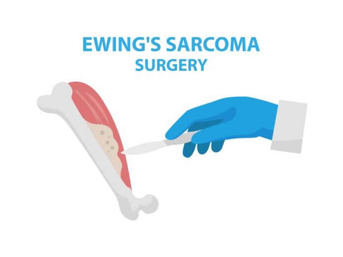 Bone Cancer - Ewing Sarcoma