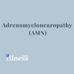 Adrenomyeloneuropathy (amn)