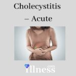 Cholecystitis – Acute