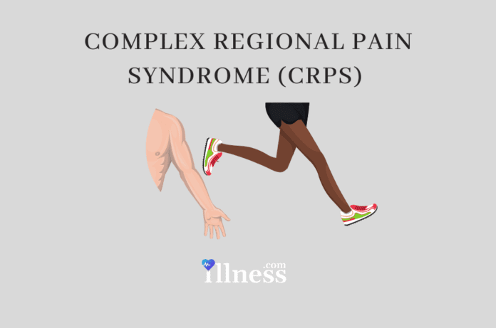 Complex Regional Pain Syndrome (crps)