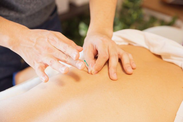Acupuncture: A Modern Doctors Opinion On Efficacy