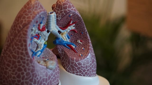 Emphysema: Life Expectancy & Can You Heal From It?